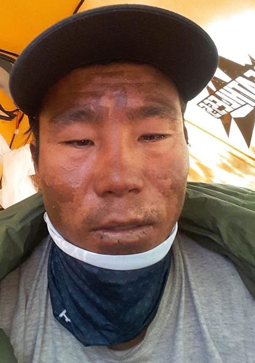El lado amargo del rescate de Wui Kin Chin